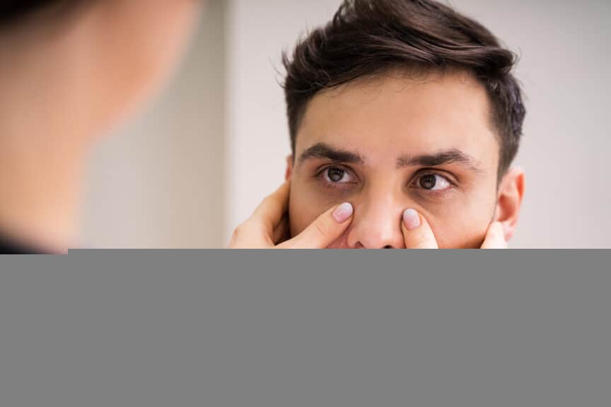 Managing the Symptoms of Nasal Polyps